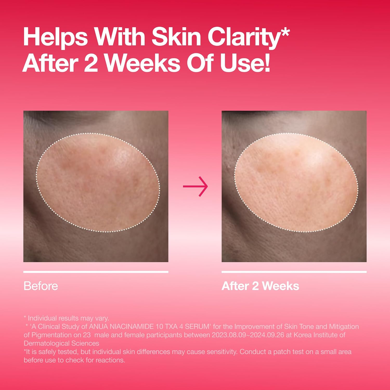 Anua Niacinamide 10 + TXA 4 Serum, Dark Spot Care, Hyaluronic Acid, Tranexamic Acid, Lightweight & Hydrating All-in-One Daily Facial Serum for Glass Skin, Korean Skincare, 1.01 fl.oz